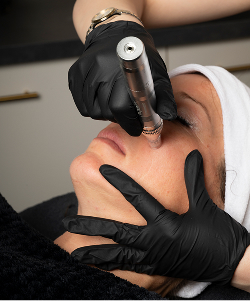 traitement de la peau à Saint-Gervais-la-Forêt dans le Loir-et-Cher 41